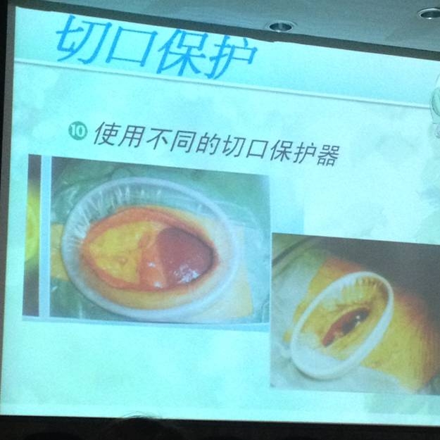 手术切口保护1.jpg 手术切口保护1.jpg